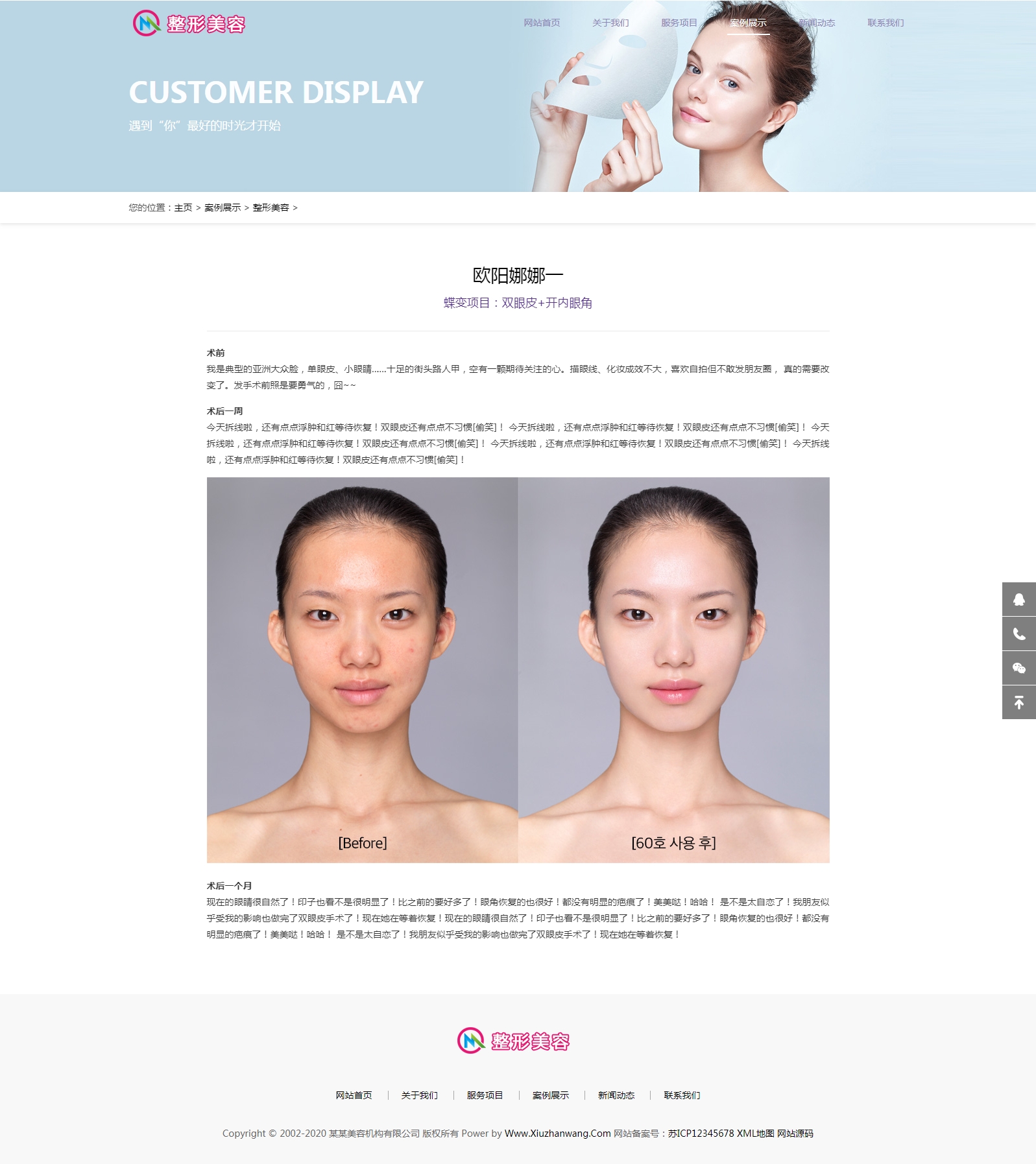 美容整形類網(wǎng)站織夢模板